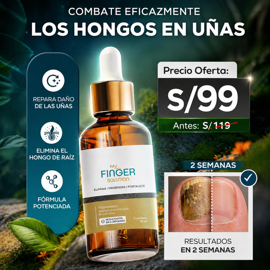 Sistema Completo de Recuperación para Uñas con Hongos – Fórmula Concentrada 30 ml