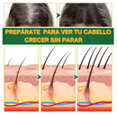 ELHOE HAIR™ - Suero para el crecimiento del cabello