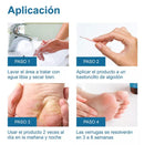 WART REMOVER | REMOVEDOR DE VERRUGAS Y LUNARES