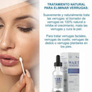 WART REMOVER | REMOVEDOR DE VERRUGAS Y LUNARES