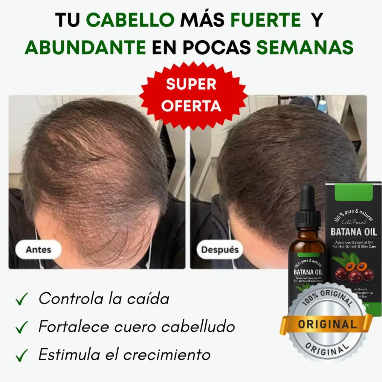 Aceite Batana™  100% Puro con Romero y Maca Nutritivo Estimula el Crecimiento Capilar y Restaura el Cabello Dañado