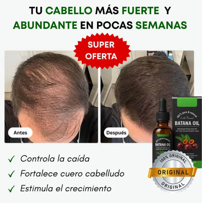 Aceite Batana™  100% Puro con Romero y Maca Nutritivo Estimula el Crecimiento Capilar y Restaura el Cabello Dañado