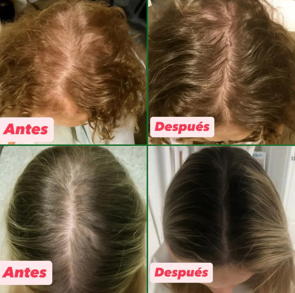 Aceite Batana™  100% Puro con Romero y Maca Nutritivo Estimula el Crecimiento Capilar y Restaura el Cabello Dañado